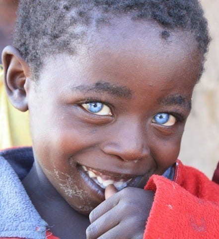 20 Amazing Pictures of Black People with Blue Eyes