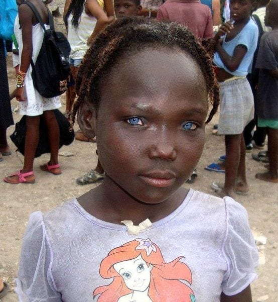 Stunning Black People with Blue Eyes (3)