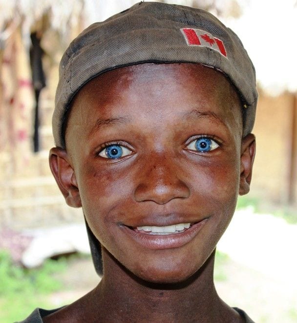 20 Amazing Pictures of Black People with Blue Eyes