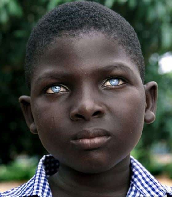 20 Amazing Pictures of Black People with Blue Eyes