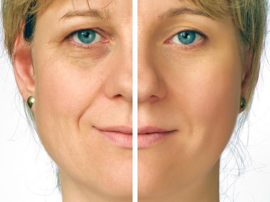 best-anti-aging-products